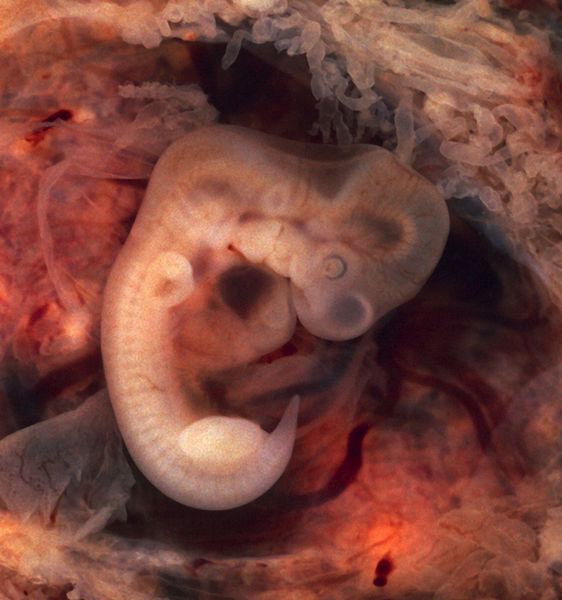 Image shows an embryo. It looks a bit like a cross between a lizard and a tadpole in shape. It has a head shaped like a turtle's. There is a wee spot where an eye will be, and wee buds where the arms will be, and it has got a tail. It's almost transparent, looking like a pale pink gummy worm.