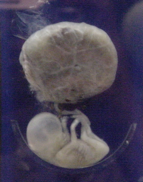 Image shows a tiny white fetus and placenta on a blue background. The placenta is a big blob, with a wee umbilical cord trailing down to the fetus, which is curled in a fetal position on its back. Its head is now a round bulb. It has long, skinny arms and legs, and a sharp butt that is losing its tail. It's not quite recognizably human, but it looks like an alien of the hominin variety.