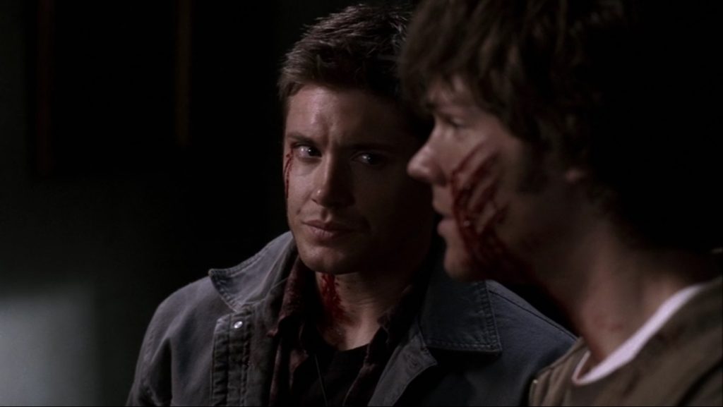 Screenshot shows Sam in profile, claw marks on his cheek, gazing earnestly at his dad off-camera. Dean is giving him some serious sideeye that says, "Seriously, Sammy?!"
