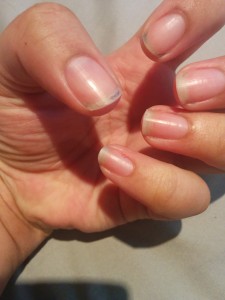 Heina's hands with uneven, ragged nails